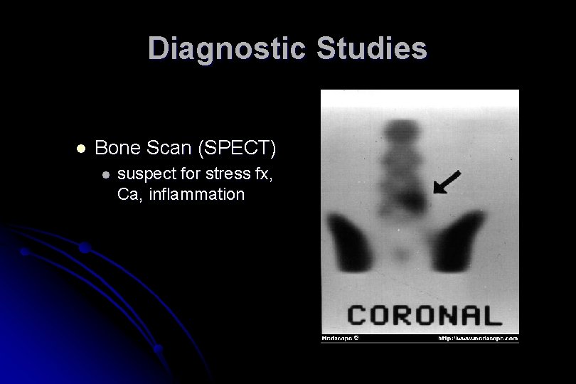 Diagnostic Studies l Bone Scan (SPECT) l suspect for stress fx, Ca, inflammation 