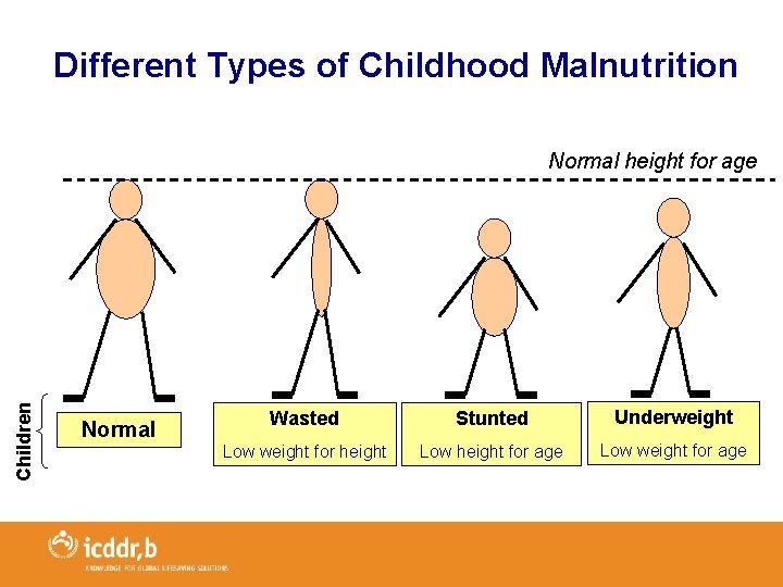 Different Types of Childhood Malnutrition Children Normal height for age Normal Wasted Stunted Underweight