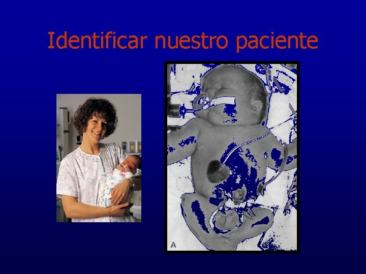 Identificar nuestro paciente 
