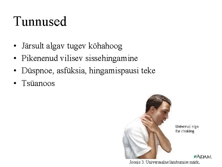 Tunnused • • Järsult algav tugev köhahoog Pikenenud vilisev sissehingamine Düspnoe, asfüksia, hingamispausi teke