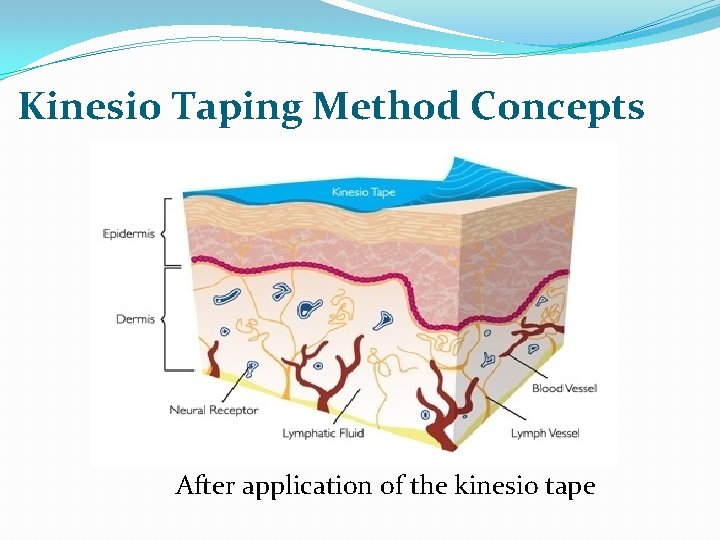 Kinesio Taping Method Concepts After application of the kinesio tape 