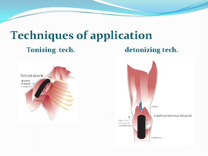 Techniques of application Tonizing tech. detonizing tech. 