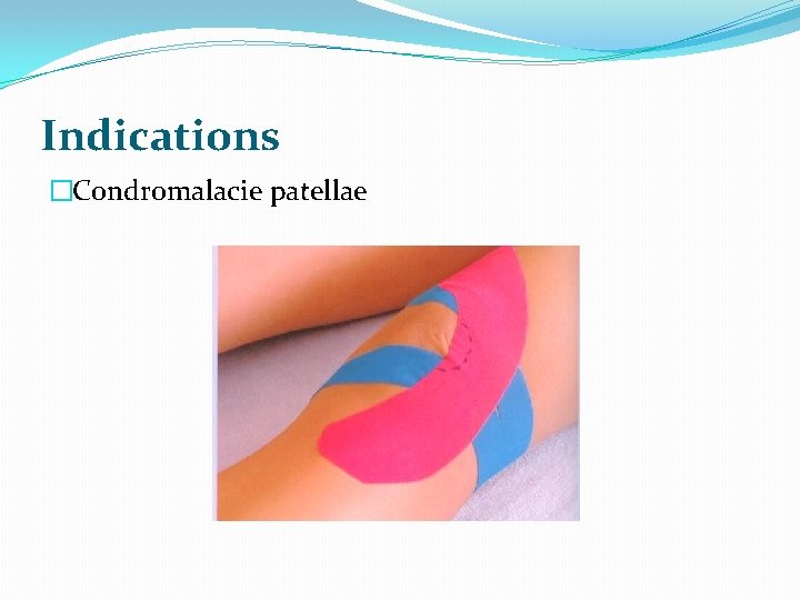 Indications �Condromalacie patellae 