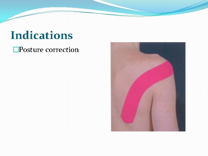 Indications �Posture correction 