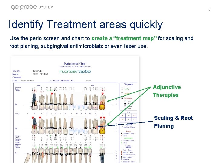 SYSTEM 9 Identify Treatment areas quickly Use the perio screen and chart to create
