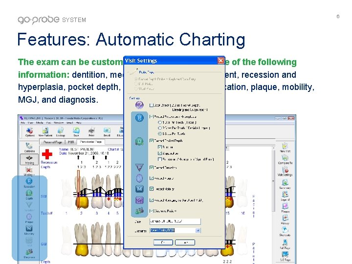 SYSTEM Features: Automatic Charting The exam can be customized to record all or some