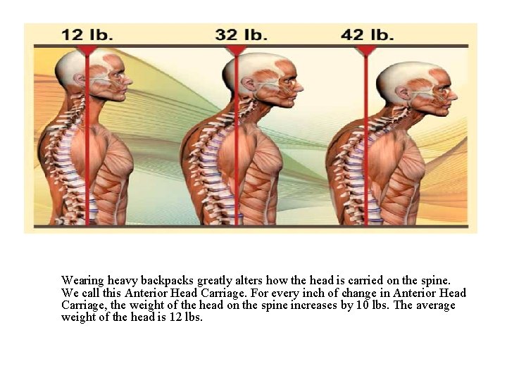 Anterior Head Carriage Wearing heavy backpacks greatly alters how the head is carried on