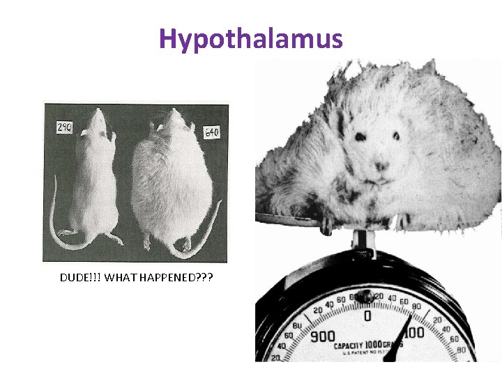 Hypothalamus DUDE!!! WHAT HAPPENED? ? ? 