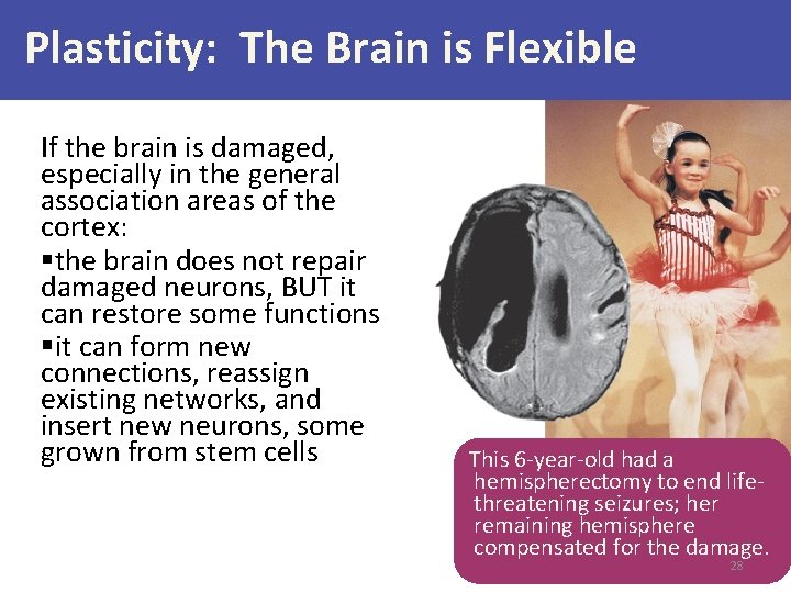 Plasticity: The Brain is Flexible If the brain is damaged, especially in the general