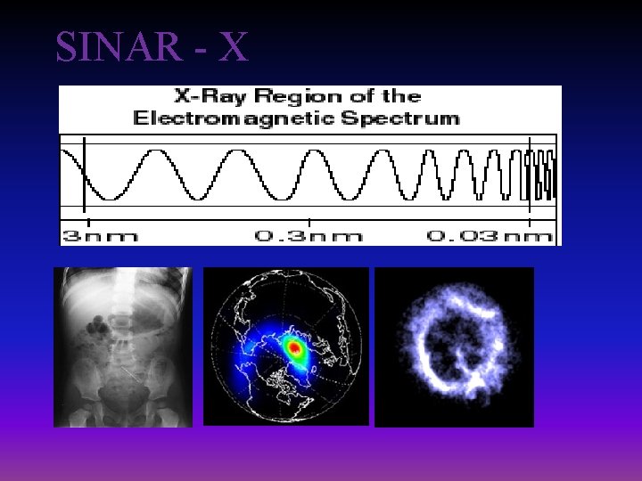 SINAR - X 