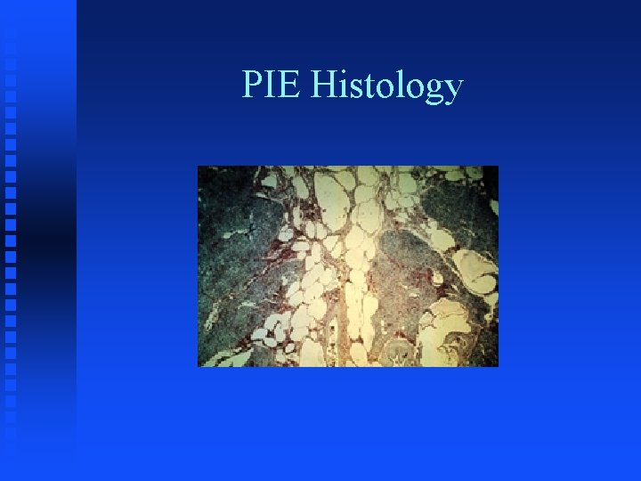 PIE Histology 