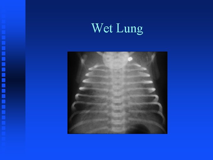 Wet Lung 