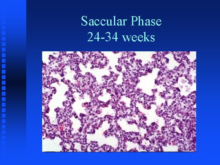 Saccular Phase 24 -34 weeks 
