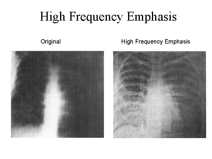 High Frequency Emphasis Original High Frequency Emphasis 