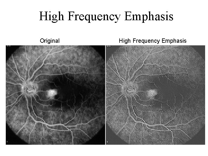 High Frequency Emphasis Original High Frequency Emphasis 