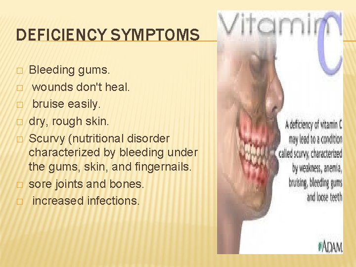 DEFICIENCY SYMPTOMS � � � � Bleeding gums. wounds don't heal. bruise easily. dry,