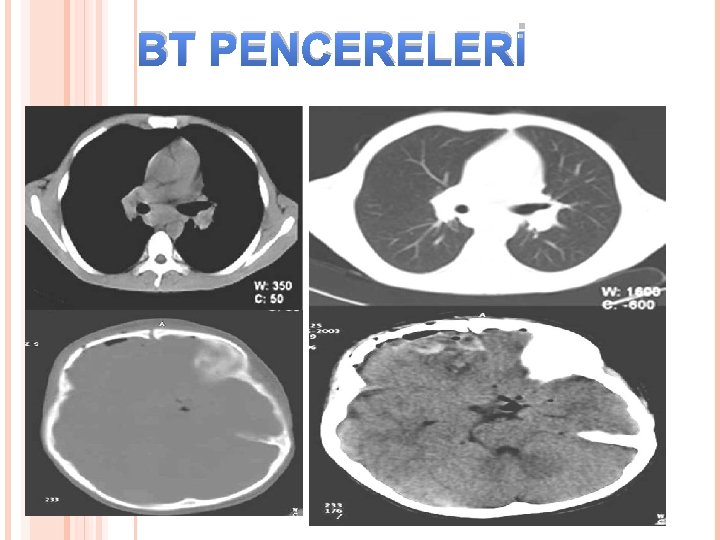 BT PENCERELERİ 