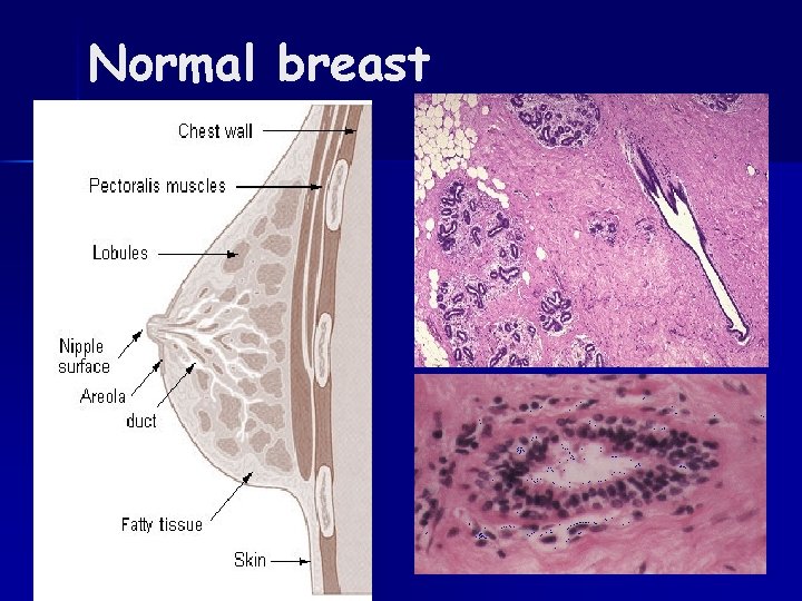 Normal breast 