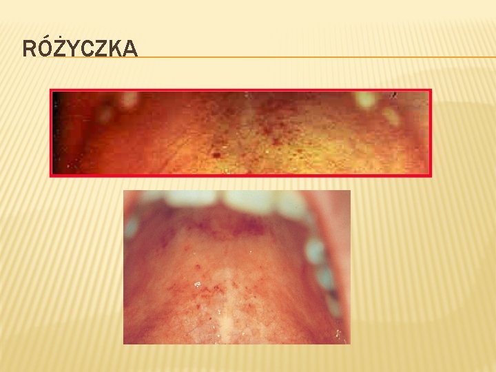 RÓŻYCZKA 