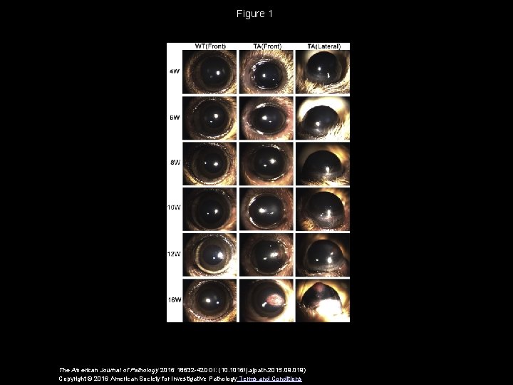 Figure 1 The American Journal of Pathology 2016 18632 -42 DOI: (10. 1016/j. ajpath.