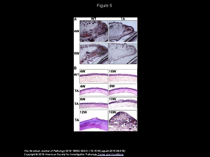 Figure 5 The American Journal of Pathology 2016 18632 -42 DOI: (10. 1016/j. ajpath.