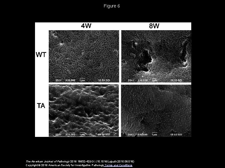 Figure 6 The American Journal of Pathology 2016 18632 -42 DOI: (10. 1016/j. ajpath.