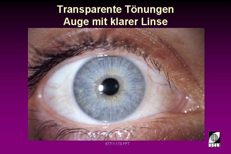 Transparente Tönungen Auge mit klarer Linse 97711 -17 S. PPT 