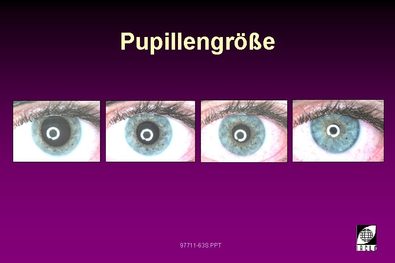 Pupillengröße 97711 -63 S. PPT 