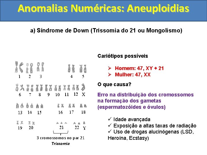 Anomalias Numéricas: Aneuploidias a) Síndrome de Down (Trissomia do 21 ou Mongolismo) Cariótipos possíveis