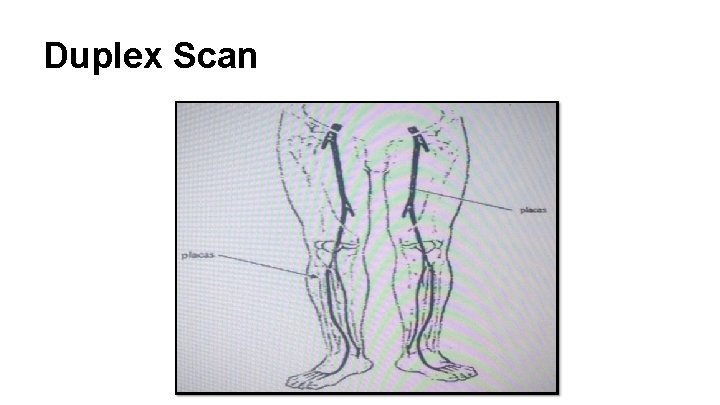 Duplex Scan 