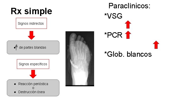 Rx simple Paraclínicos: *VSG Signos indirectos *PCR ● de partes blandas *Glob. blancos Signos