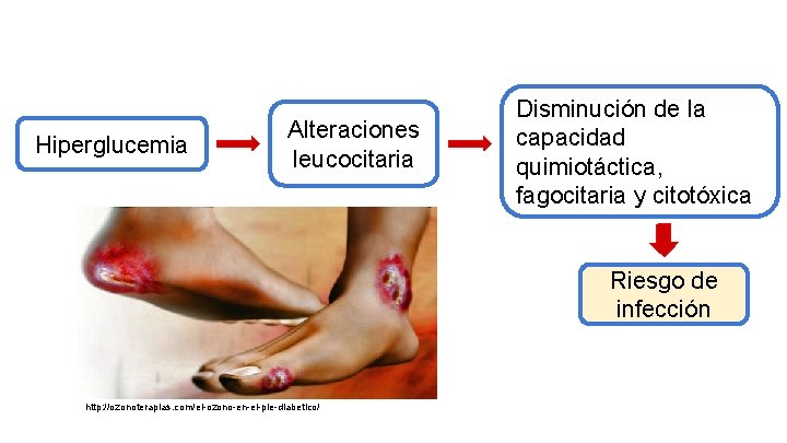 Hiperglucemia Alteraciones leucocitaria Disminución de la capacidad quimiotáctica, fagocitaria y citotóxica Riesgo de infección