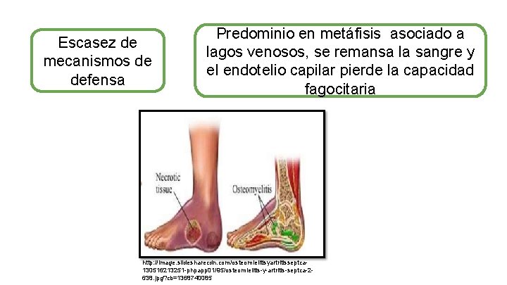 Escasez de mecanismos de defensa Predominio en metáfisis asociado a lagos venosos, se remansa