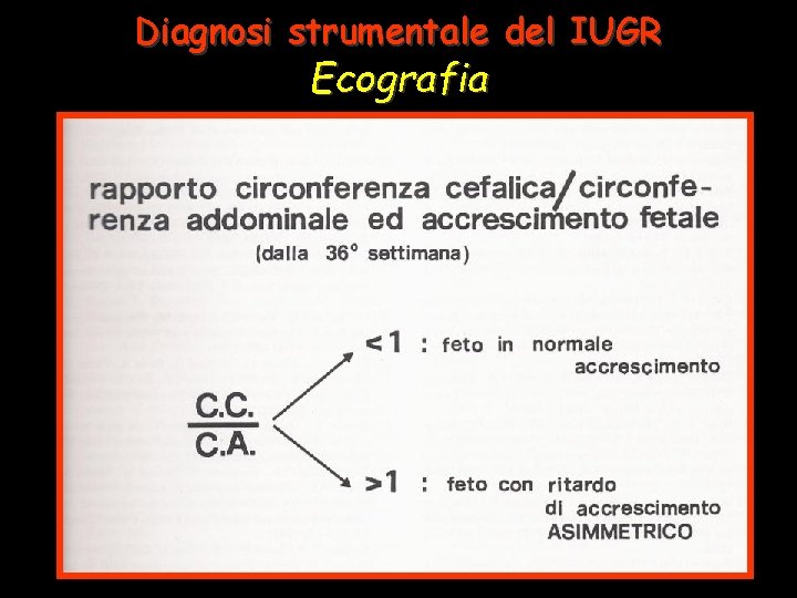 Diagnosi strumentale del IUGR Ecografia 