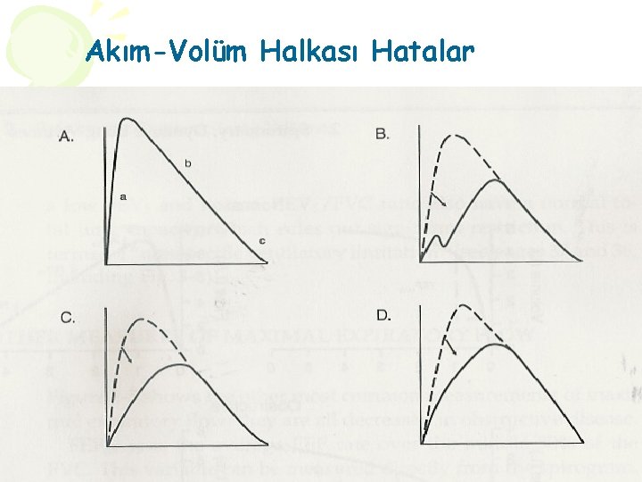 Akım-Volüm Halkası Hatalar 