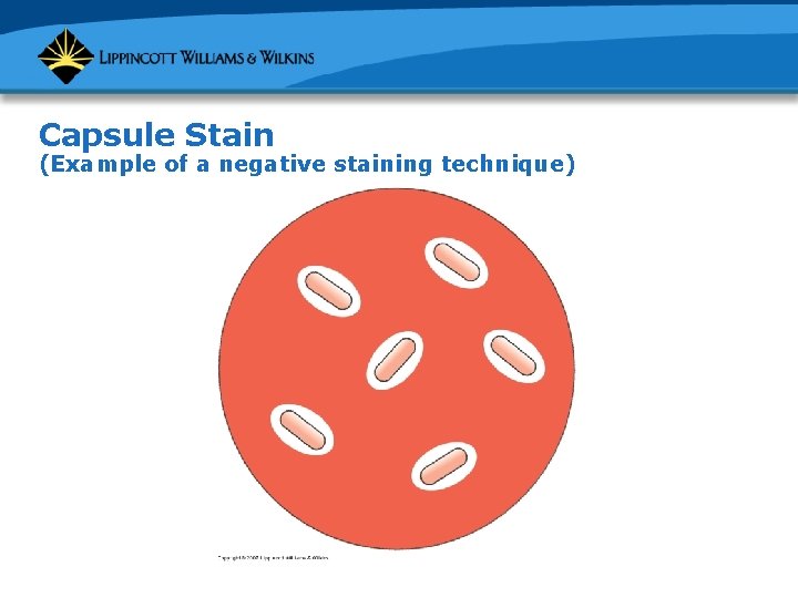 Capsule Stain (Example of a negative staining technique) 