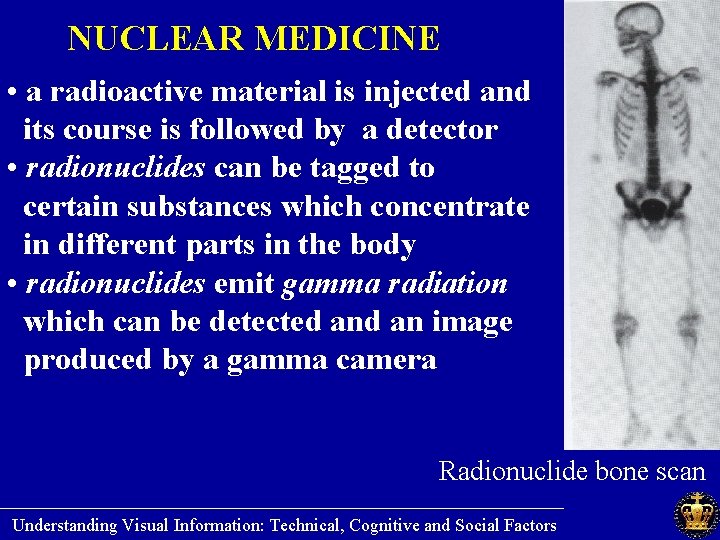 NUCLEAR MEDICINE • a radioactive material is injected and its course is followed by