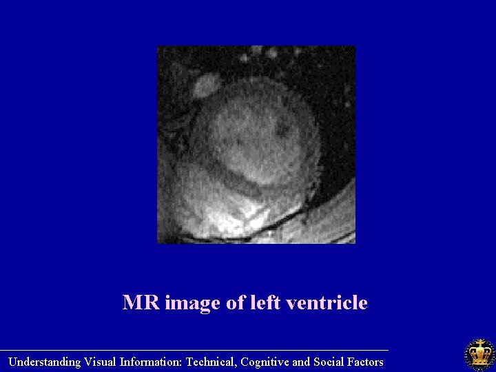 MR image of left ventricle ________________________ Understanding Visual Information: Technical, Cognitive and Social Factors