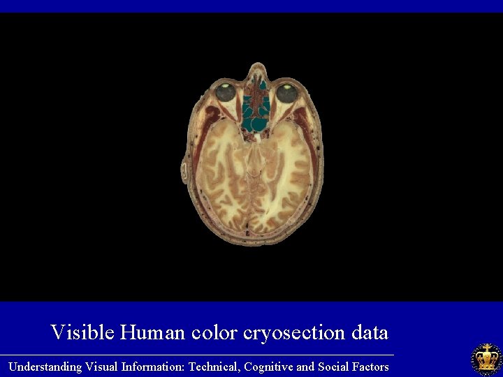 Visible Human color cryosection data ________________________ Understanding Visual Information: Technical, Cognitive and Social Factors