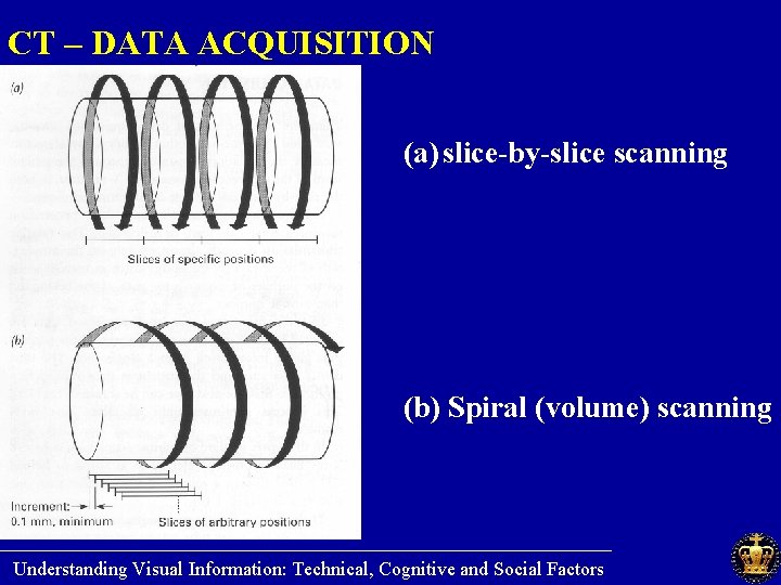 CT – DATA ACQUISITION (a) slice-by-slice scanning (b) Spiral (volume) scanning ________________________ Understanding Visual