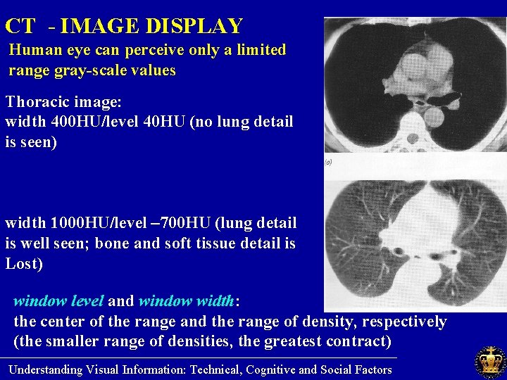CT - IMAGE DISPLAY Human eye can perceive only a limited range gray-scale values