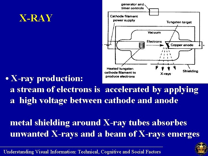 X-RAY • X-ray production: a stream of electrons is accelerated by applying a high