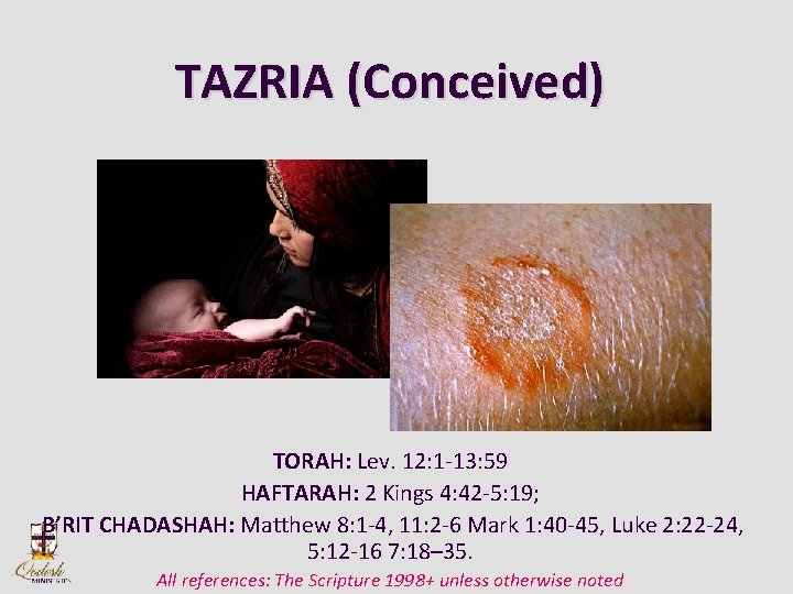 TAZRIA (Conceived) TORAH: Lev. 12: 1 -13: 59 HAFTARAH: 2 Kings 4: 42 -5: