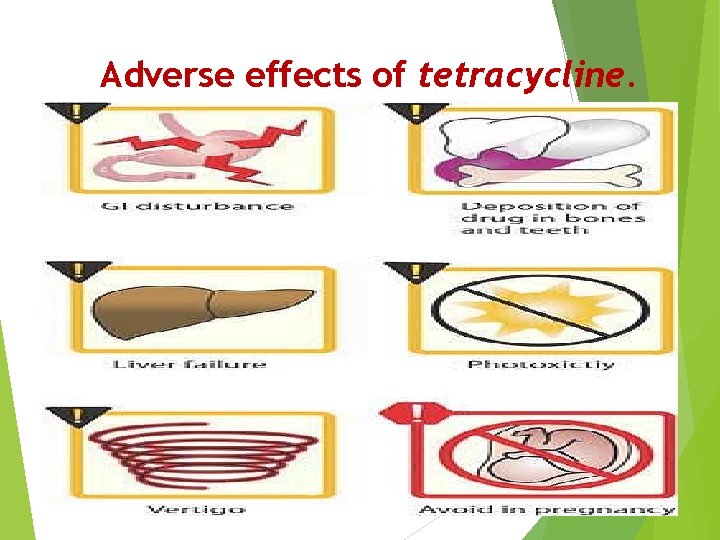 Adverse effects of tetracycline. 