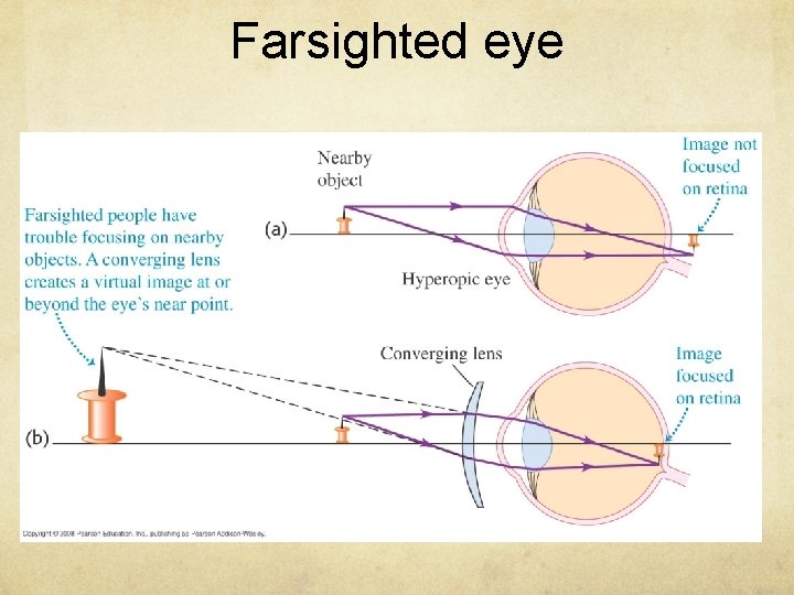 Farsighted eye 