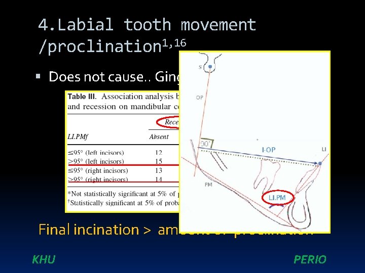 4. Labial tooth movement /proclination 1, 16 Does not cause. . Gingival recession Final