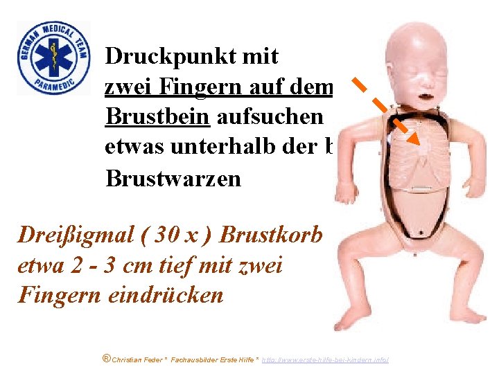 Druckpunkt mit zwei Fingern auf dem Brustbein aufsuchen etwas unterhalb der beiden Brustwarzen Dreißigmal