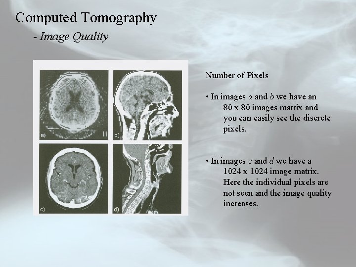 Computed Tomography - Image Quality Number of Pixels • In images a and b