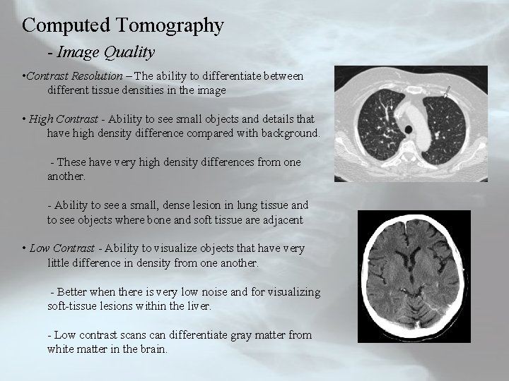 Computed Tomography - Image Quality • Contrast Resolution – The ability to differentiate between
