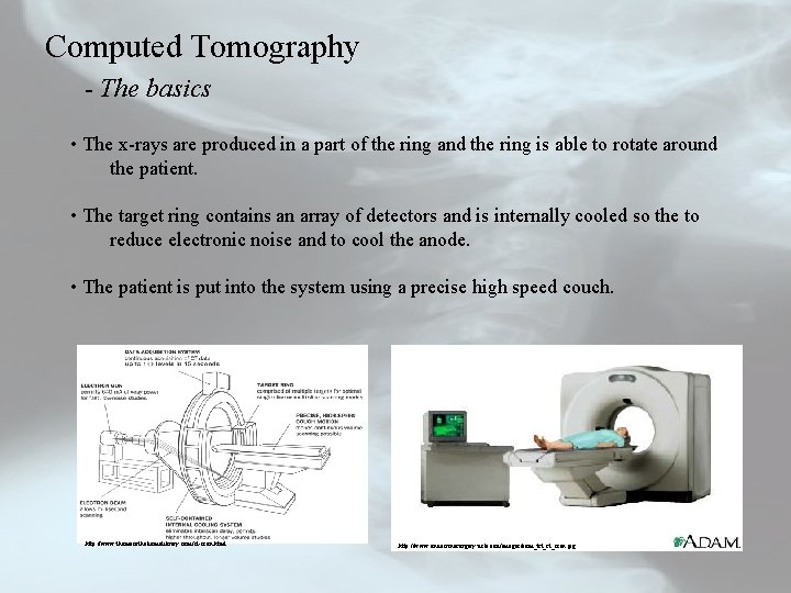 Computed Tomography - The basics • The x-rays are produced in a part of